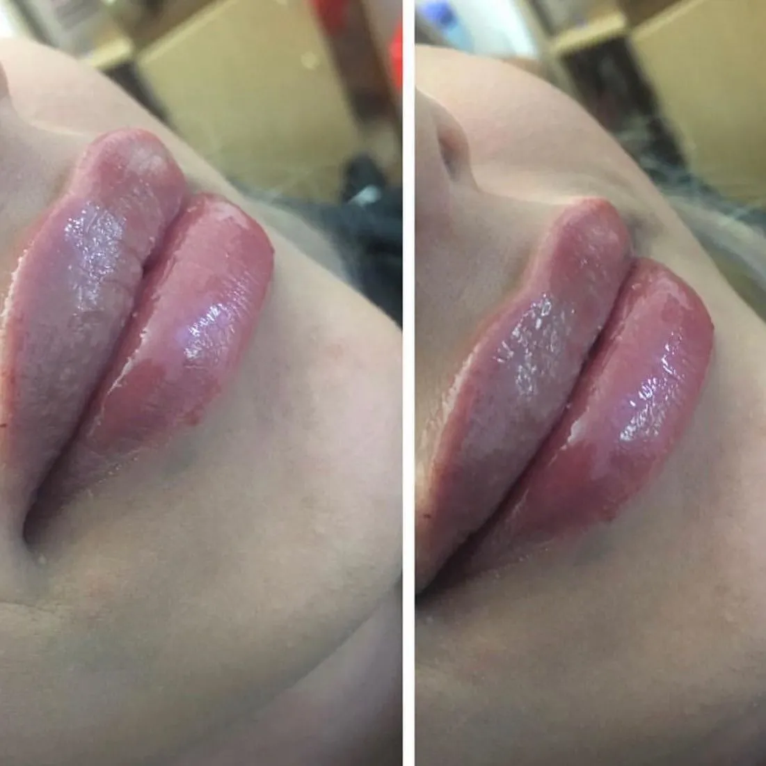 Företag 2 bild LASER KLINIK BEAUTY - SKÖNHETSKLINIK VASASTAN