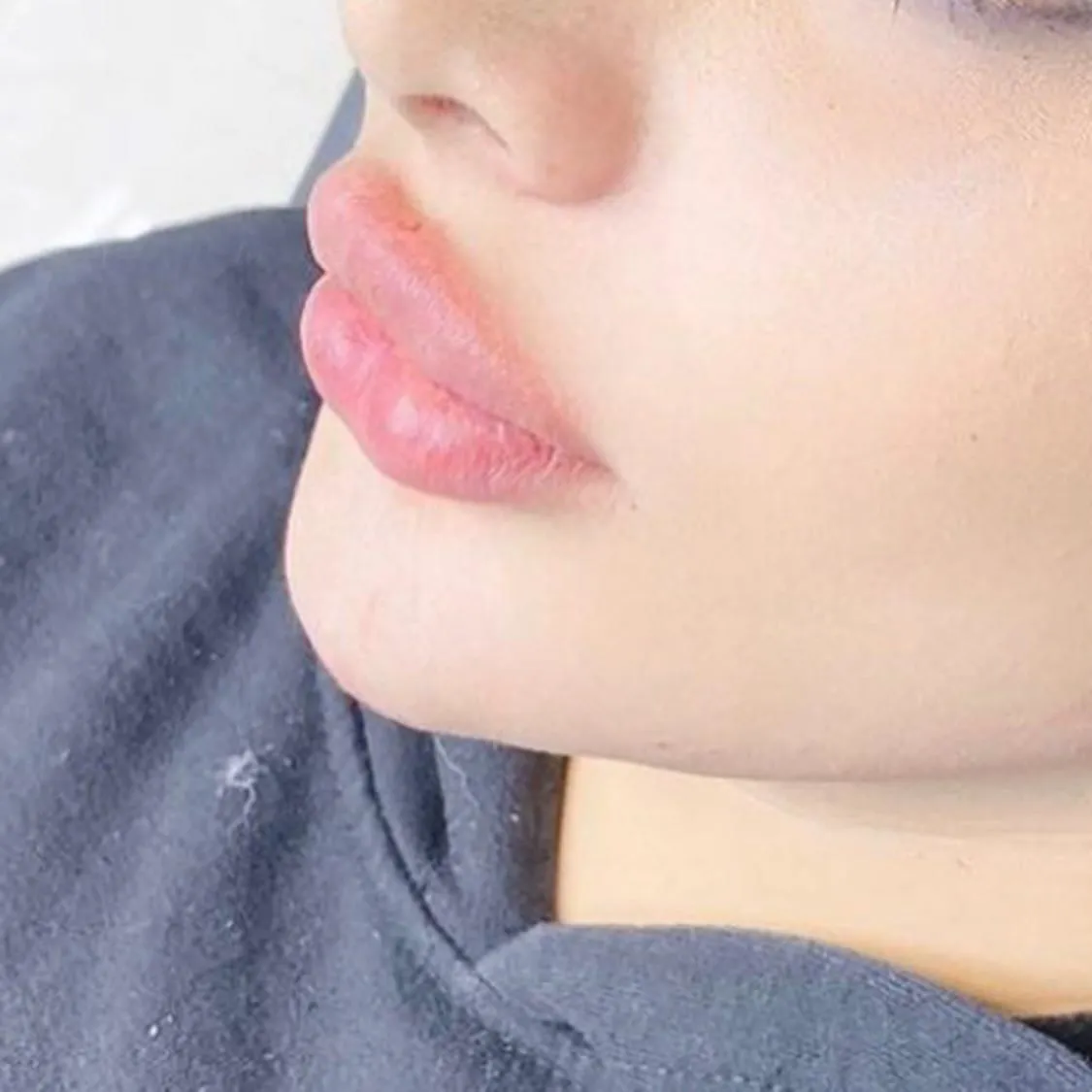 Företag 3 bild LASER KLINIK BEAUTY - SKÖNHETSKLINIK VASASTAN